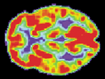 Normal brain scan